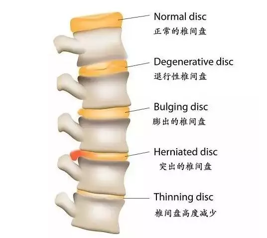 瑜伽瘦腿長(zhǎng)高，現(xiàn)在開(kāi)始練還不遲